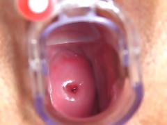 Nurse Greta shows her womb tube porn video