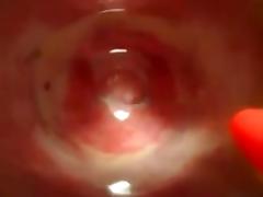 Cup in vagina tube porn video