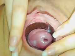 shy cervix tube porn video
