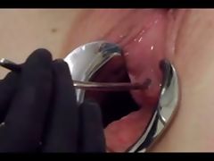 Female Urethral Sounding tube porn video