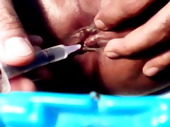 ass hole tortured tube porn video