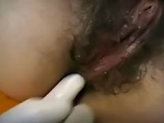 Doctor Removes Bandages To Real Her Unshaved Arse And Fucks It tube porn video