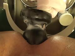 Giant speculum, fist, double fist, giant toy, nurse, doctor tube porn video